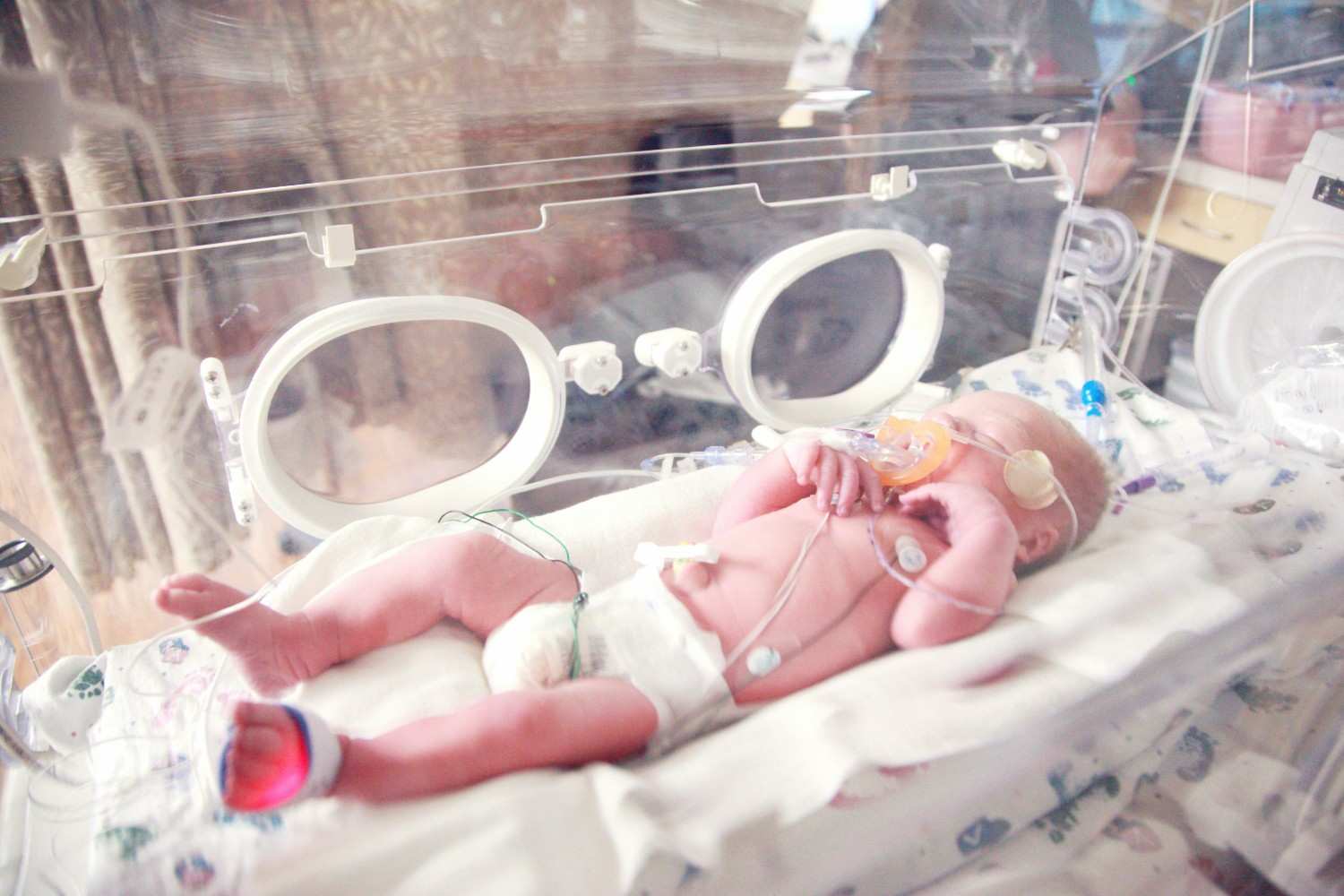Plastic-Contaminated Foods Linked to Increased Premature Births Risk